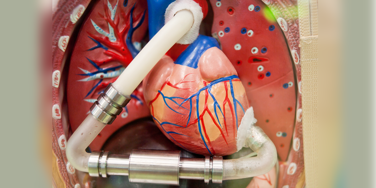 Dispositivos de asistencia ventricular en insuficiencia cardiaca. Lo que el clínico debe conocer